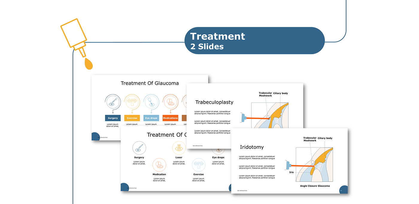 Glaucoma Powerpoint template presentation design editable animated rxslides