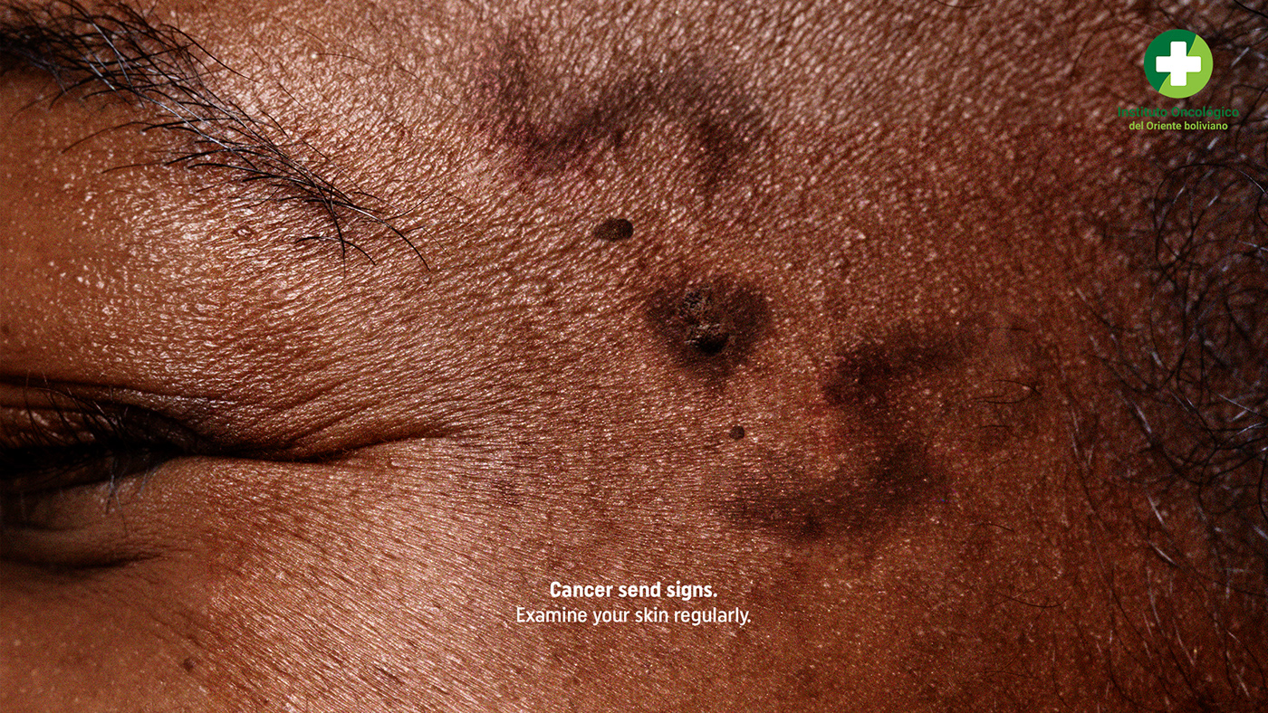cancer cancer awareness cancer campaign Advertising  ads cancer de piel skin cancer skin cancer awareness Melanoma Health