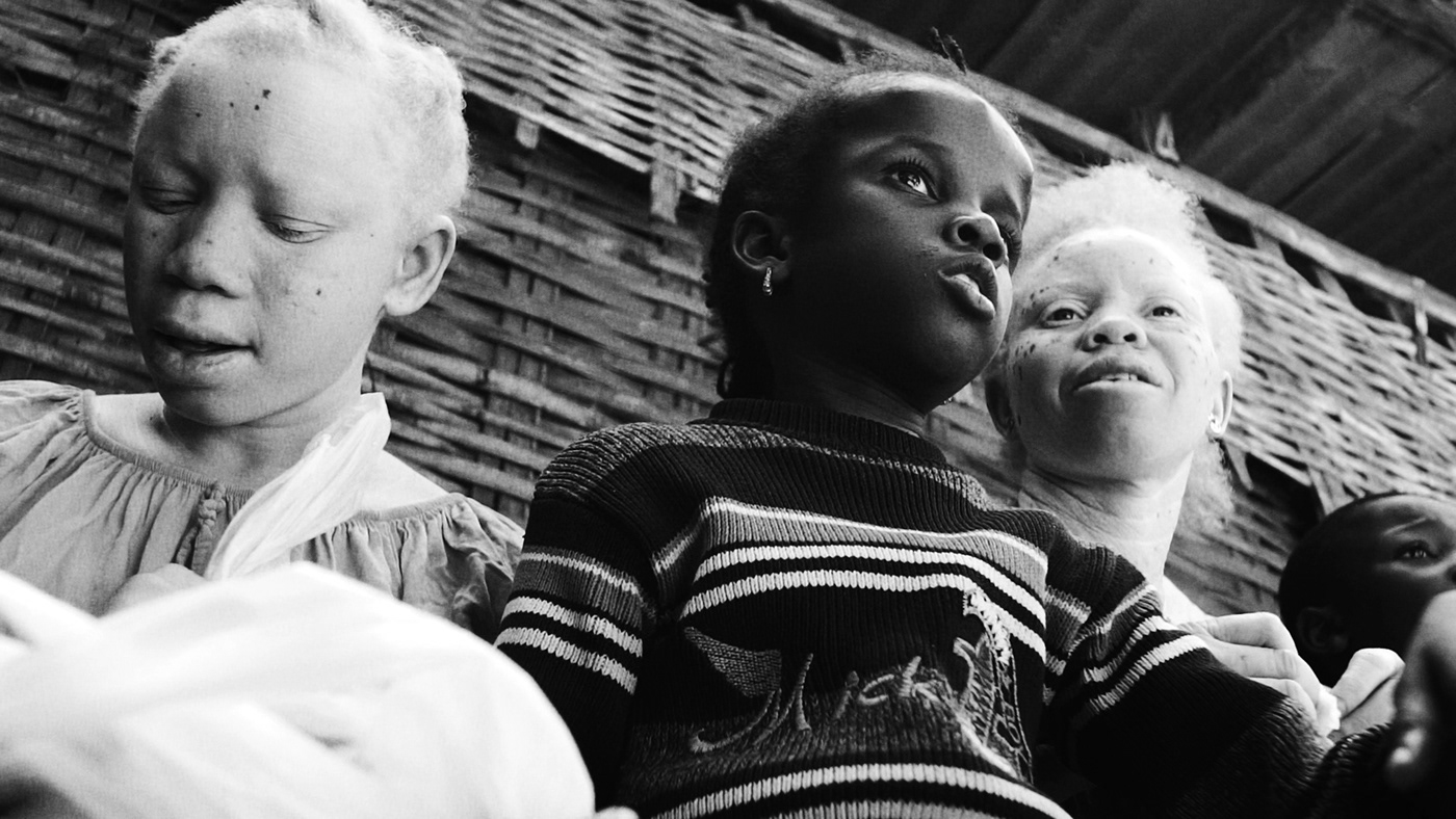 africa albinos Documentary  people