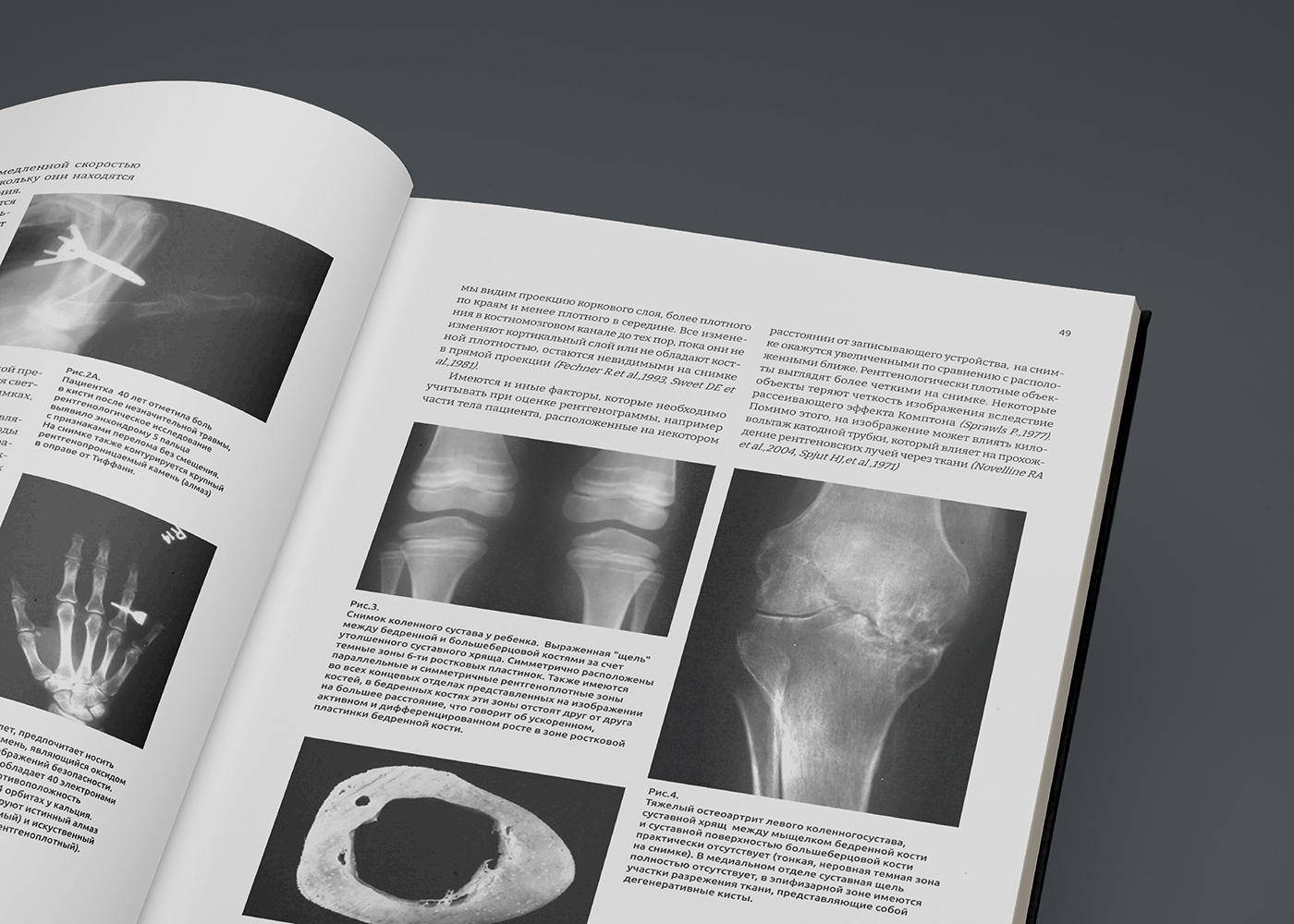 atlas book book design cover editorial Layout medicine pathology
