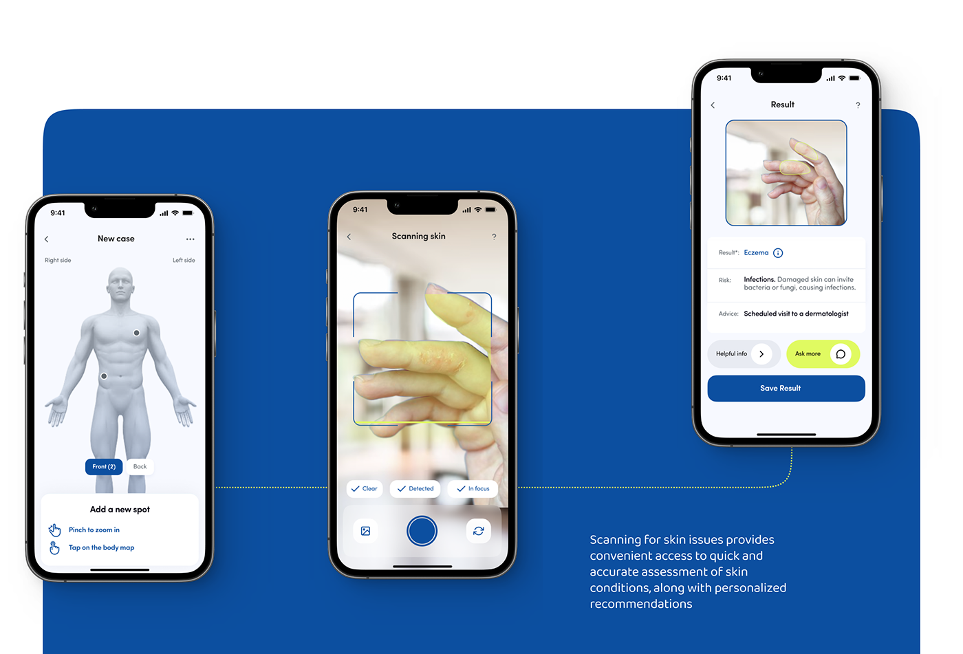 #behance healthcare scanner Mobile app vitals skin UI/UX Figma app design medical
