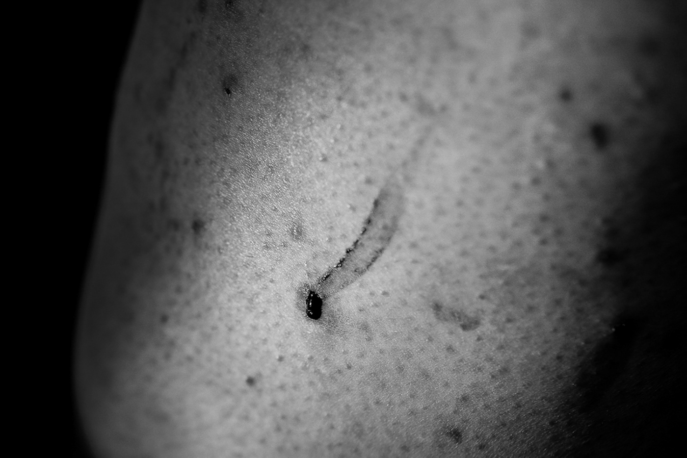 black and white body skin macro abstract minimal depression unknown anxiety flesh