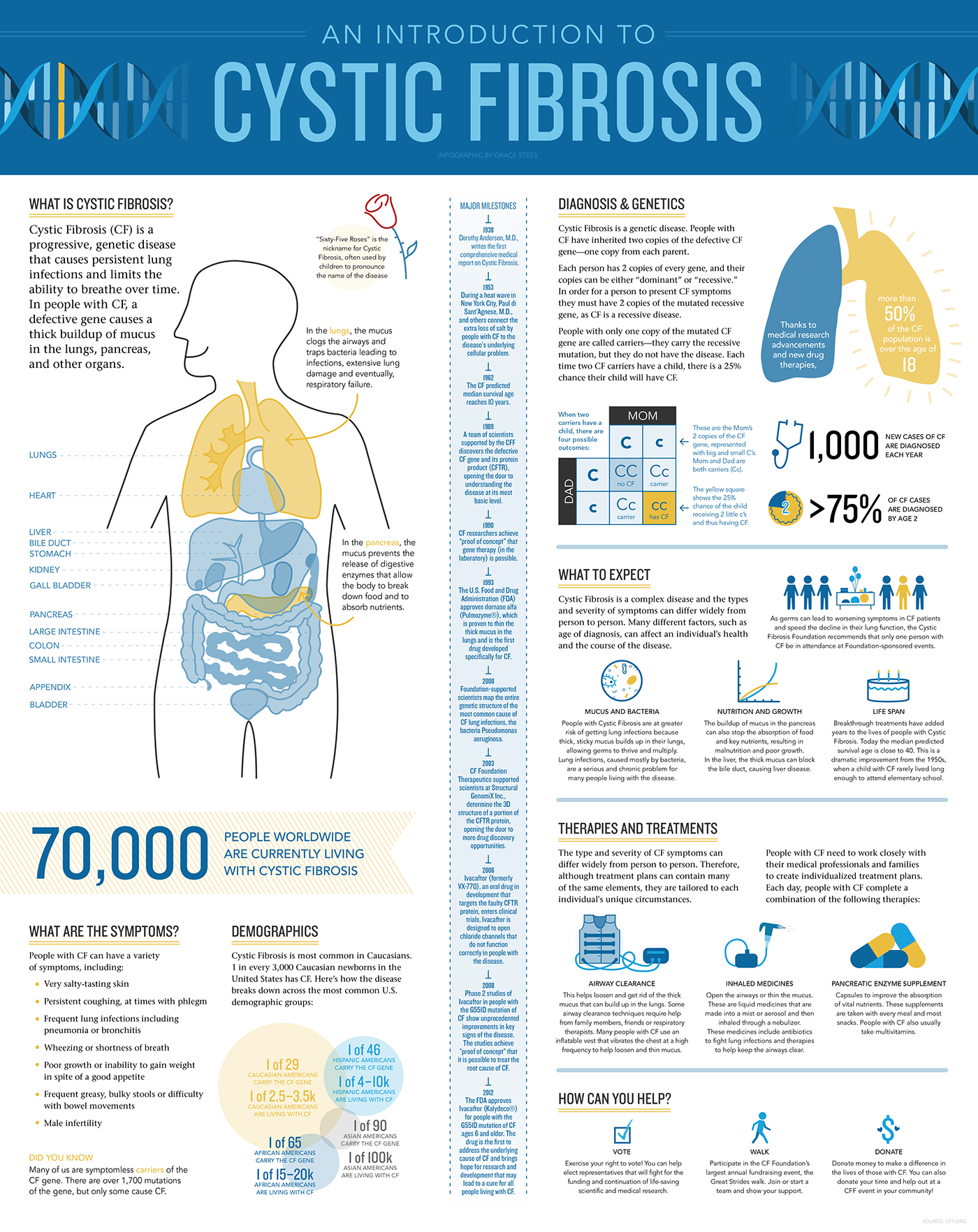 cystic fibrosis cf infographic
