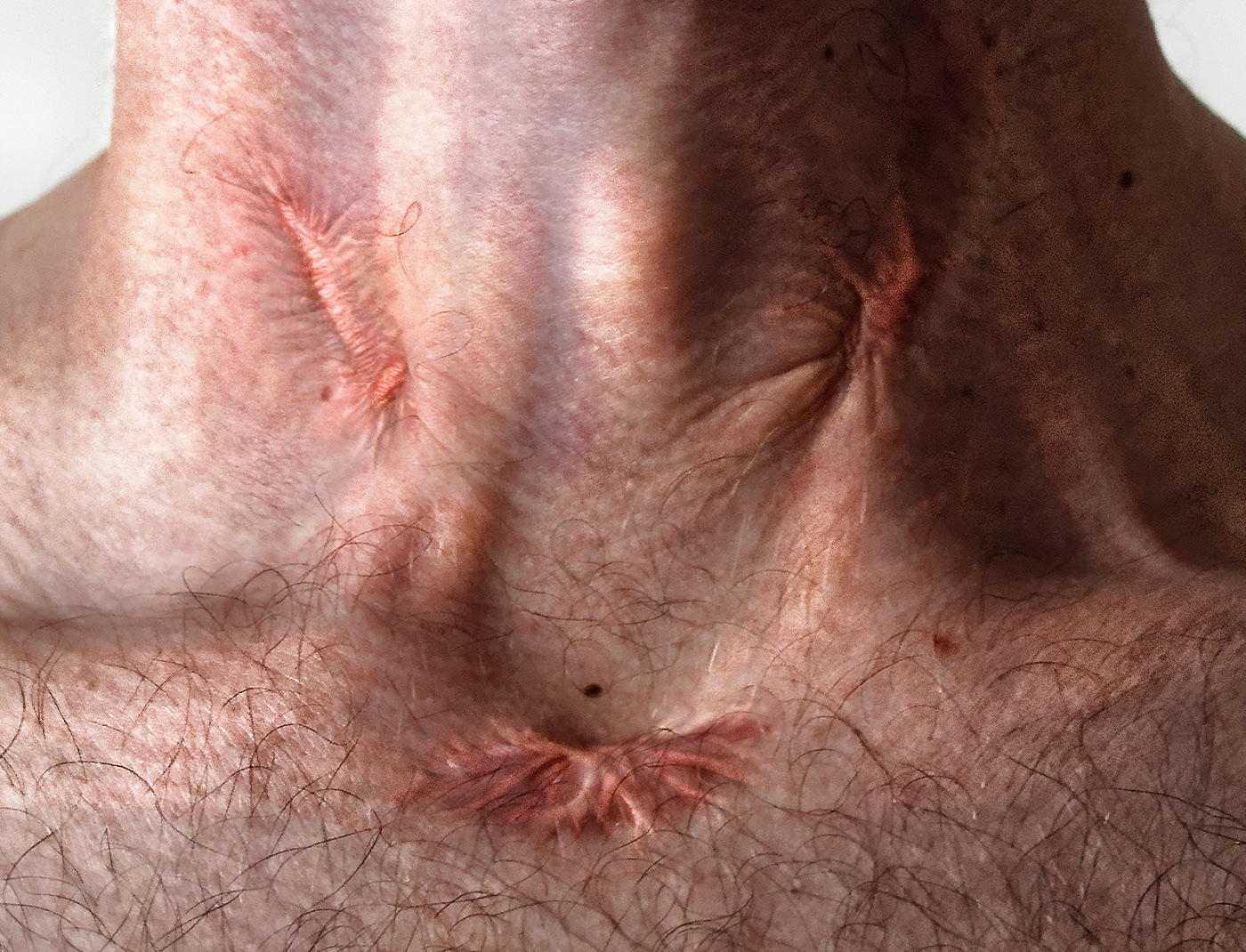 body cicatrice cicatrisation digital painting man model Photography  scar sensual skin