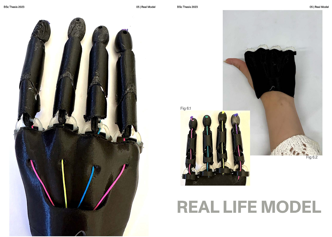 prosthetics hand customizable 3d printing 3d design modelling amputee user experience mechanical