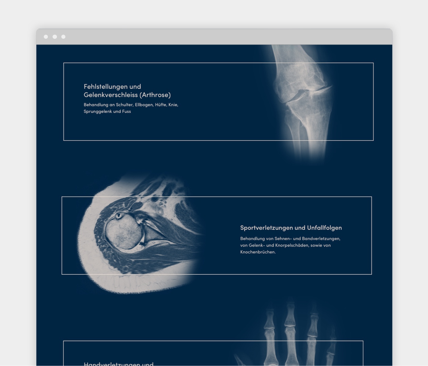 branding  Webdesign surgery cut blue beige Orthopaedics tellssoehne