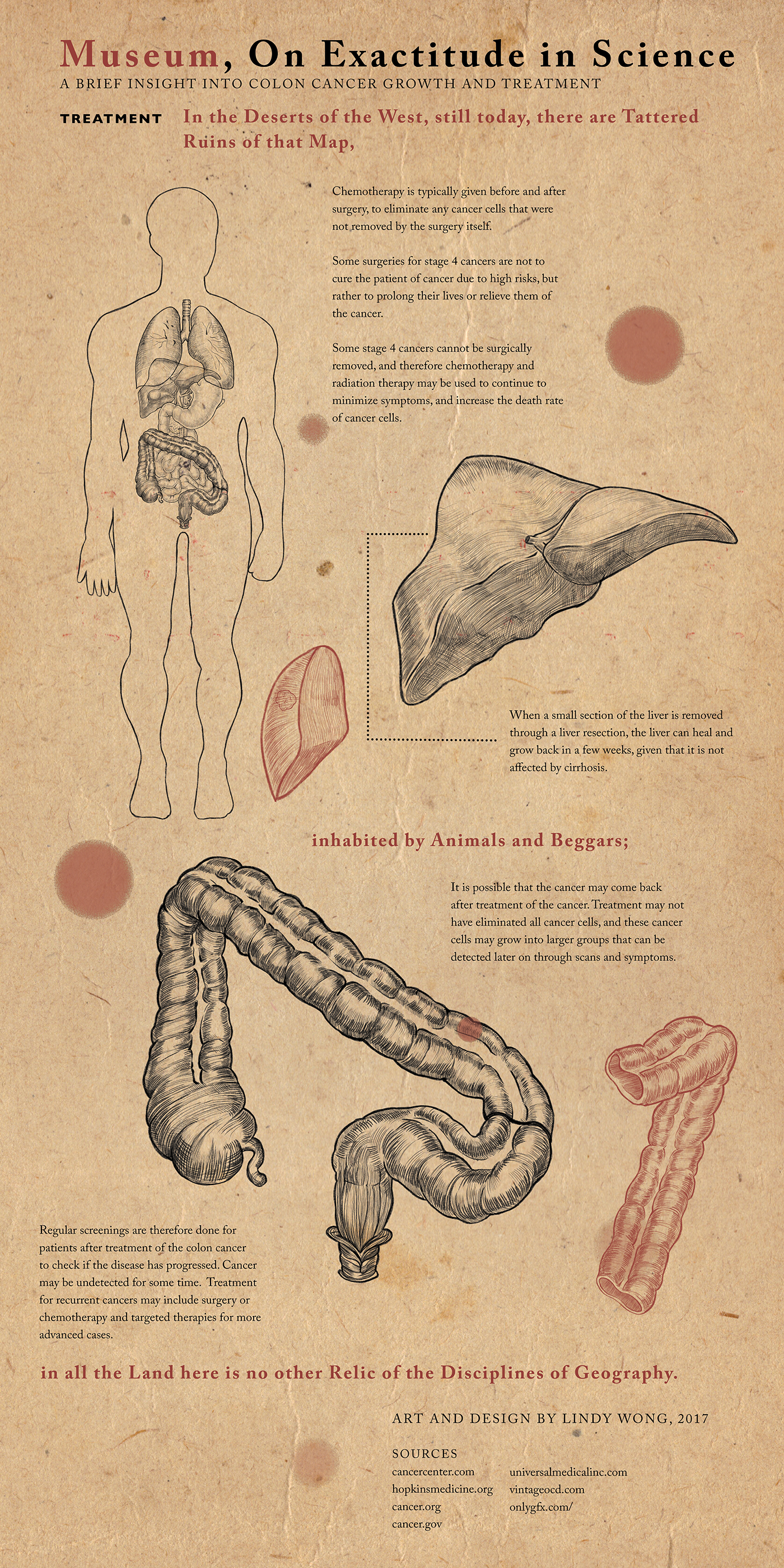 anatomy posters medical Colon Cancer sketch diagram series science scientific museum