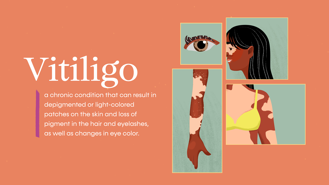 design Graphic Designer vitiligo medical Health skin 2D