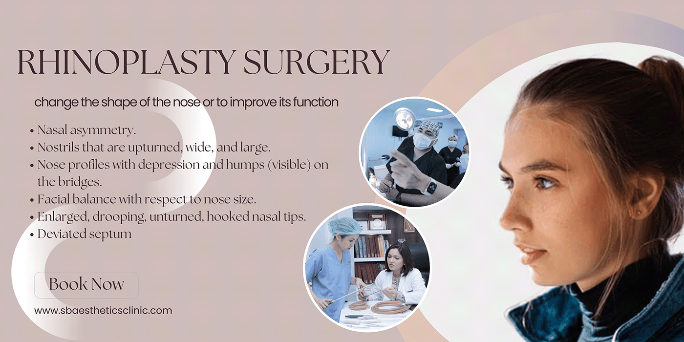rhinoplasty surgery 