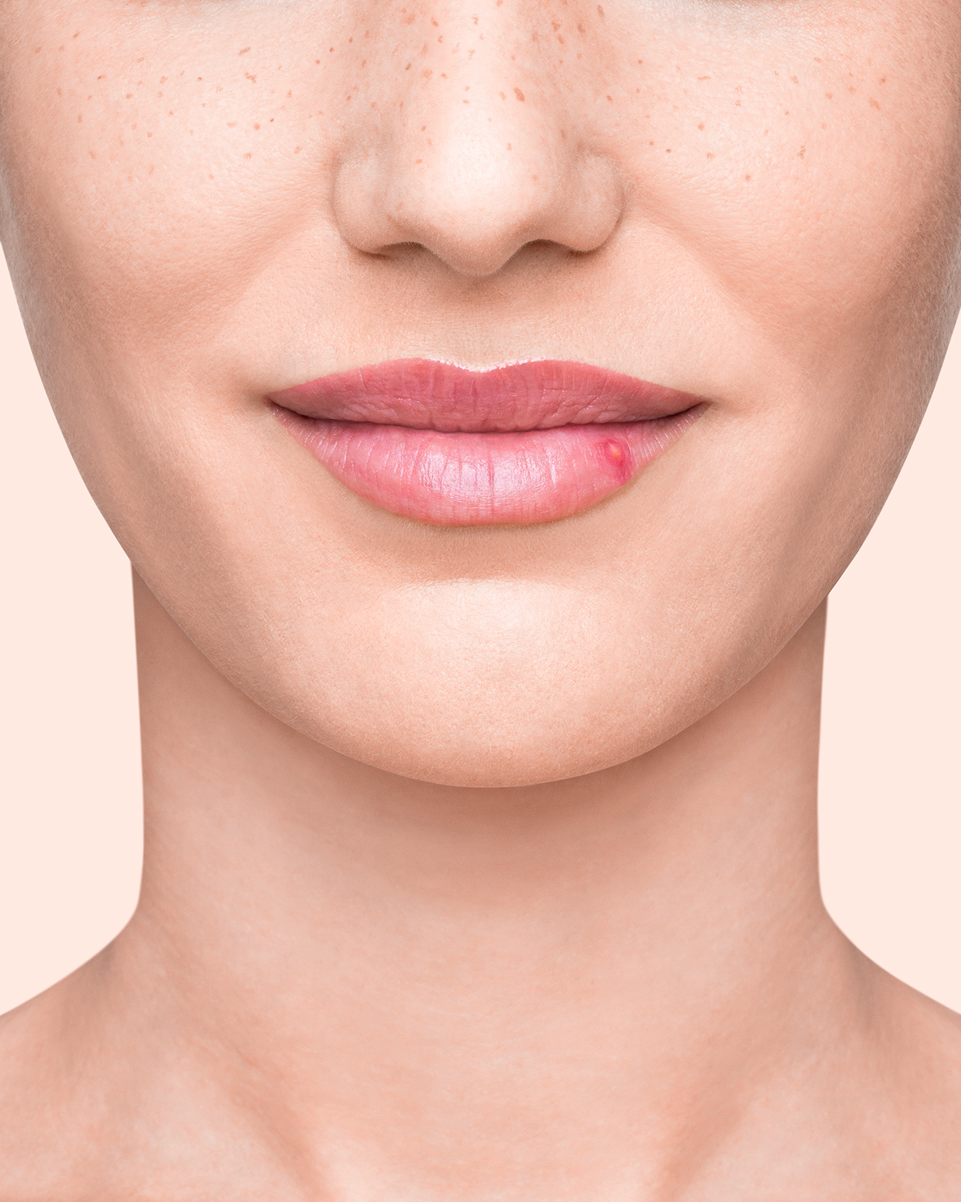 beauty cure disorder epidemic girl lips medicine model skin retouch