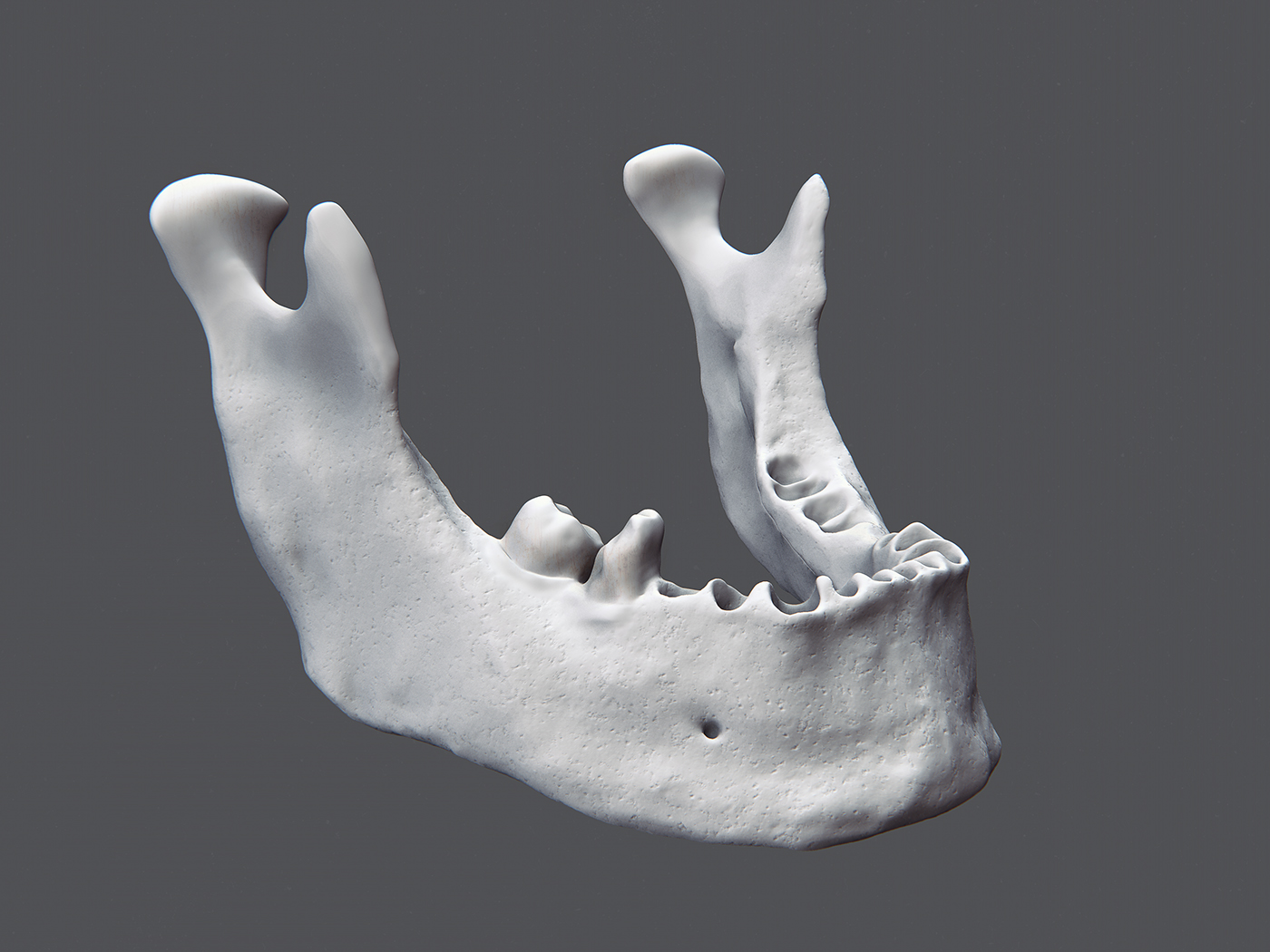 3d printing mandibular modelling
