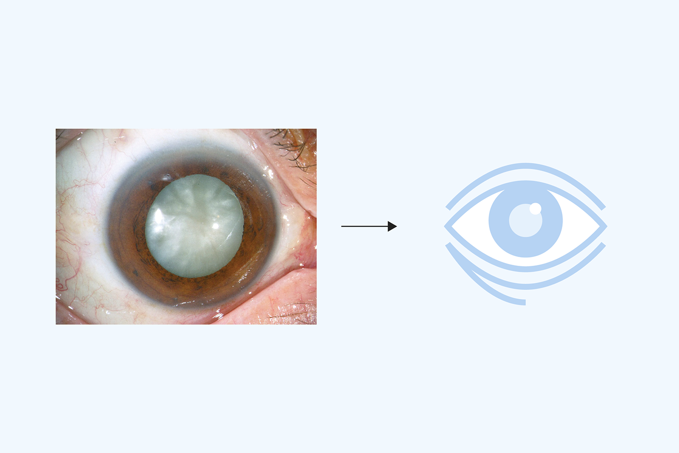 barcelona dubai eye forma ophthalmology pathologies Treatments