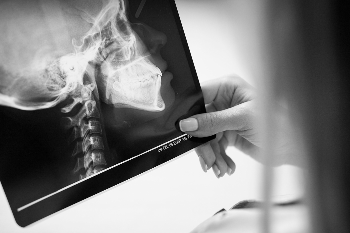 Web x-ray diagnostics UI ux Interface bw x-ray medicine