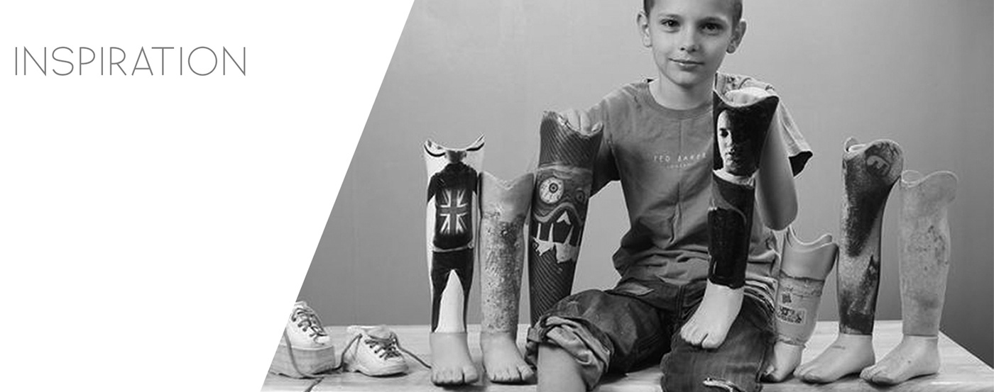 prosthetic prosthetic leg adjustable children ring Serbia Design Snezana Jeremic srbija dizajn industrial design  snezana jeremic design