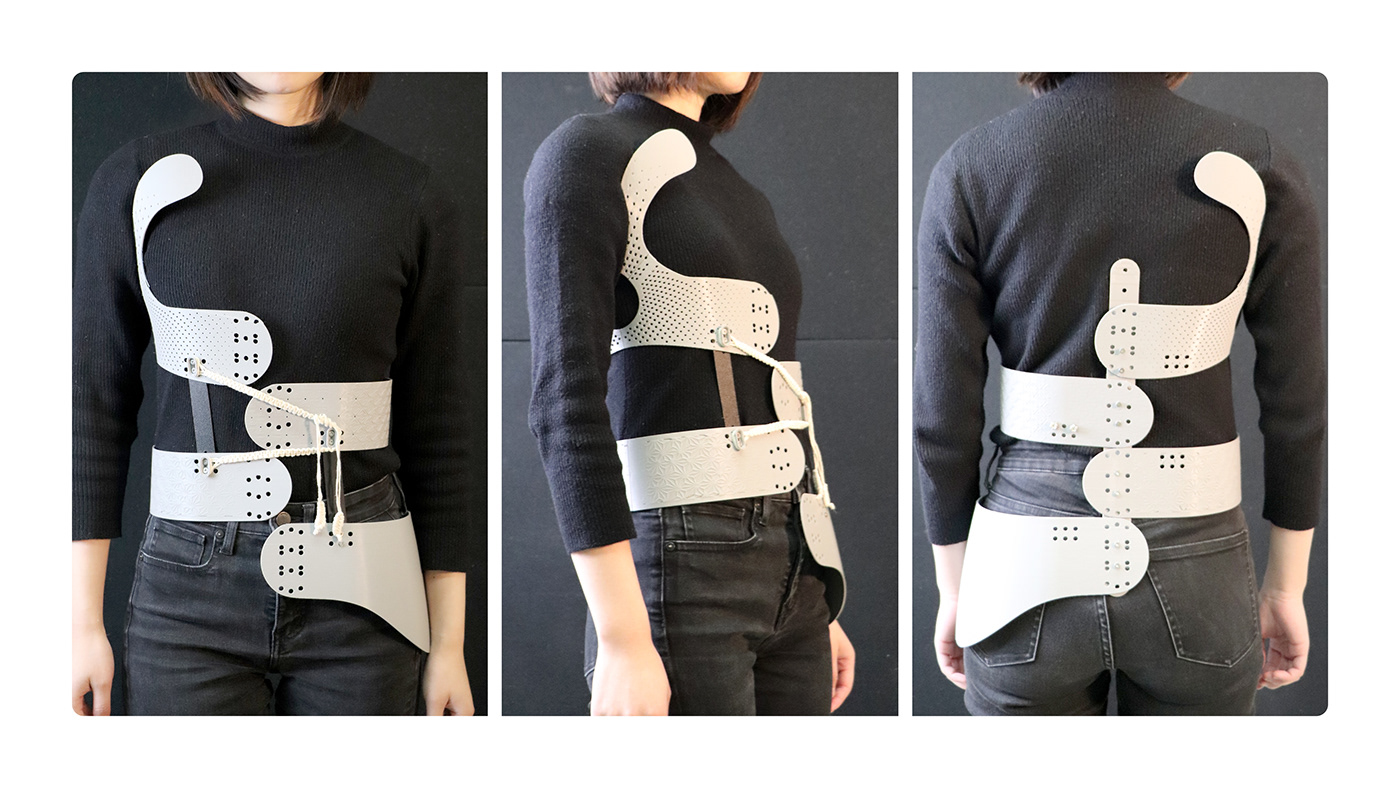 Health industrial design  medical device scoliosis Scoliosis Brace daap
