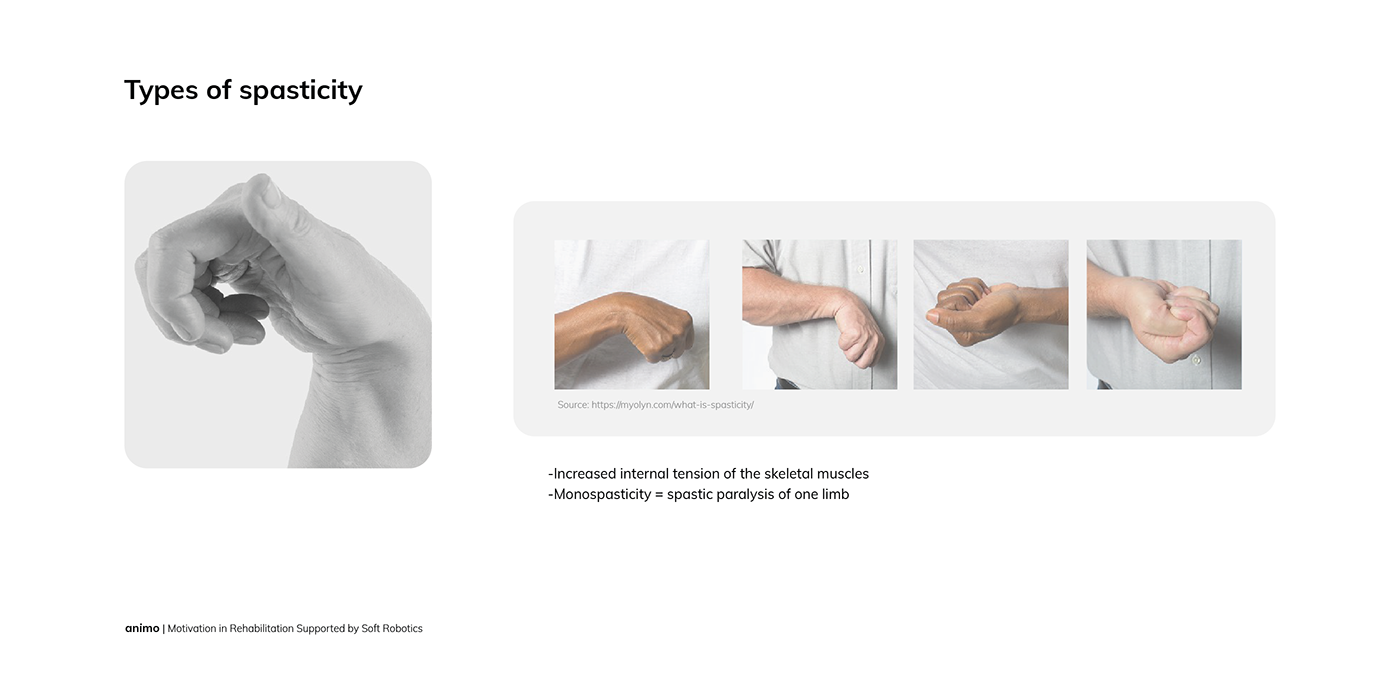 design product design  Packaging concept design rehabilitation spasticity