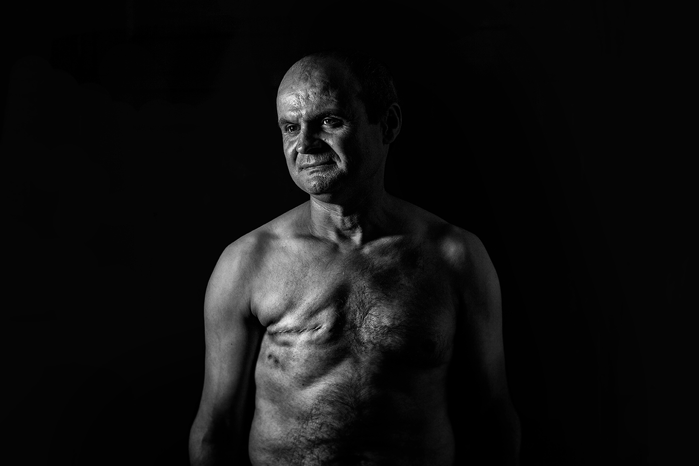 breast cancer cancer men breast cancer Jose Ferreira  jose ferreira photographer cancer docuemntary Documentary 
