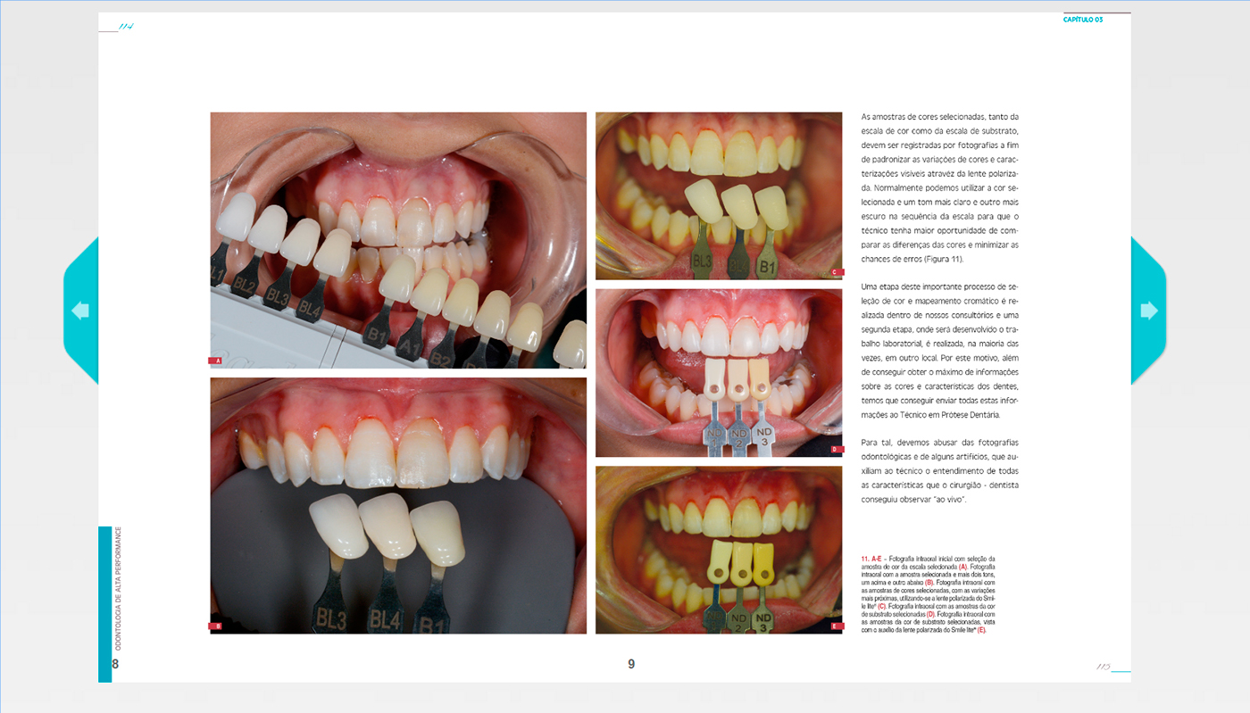 #illustration #odonto #ilustração #3dsmax #photoshop #humanfigure #Anatomía #craniofacial #dentistry