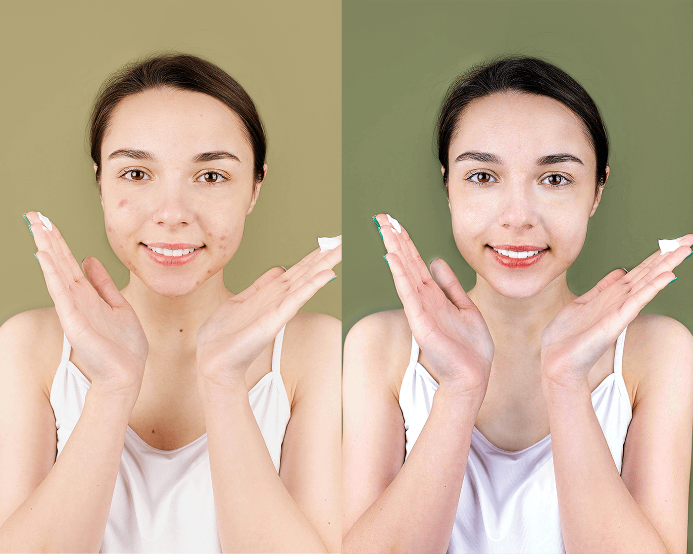 photoshop retouching  portrait retouch ретушер beauty photo acne acne removal retouched