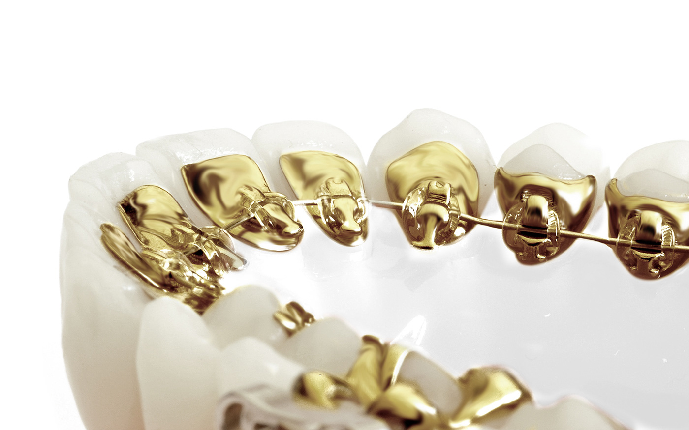 dental logo gold teeth braces Greece sophiagdotcom smile orthodontist ioannina