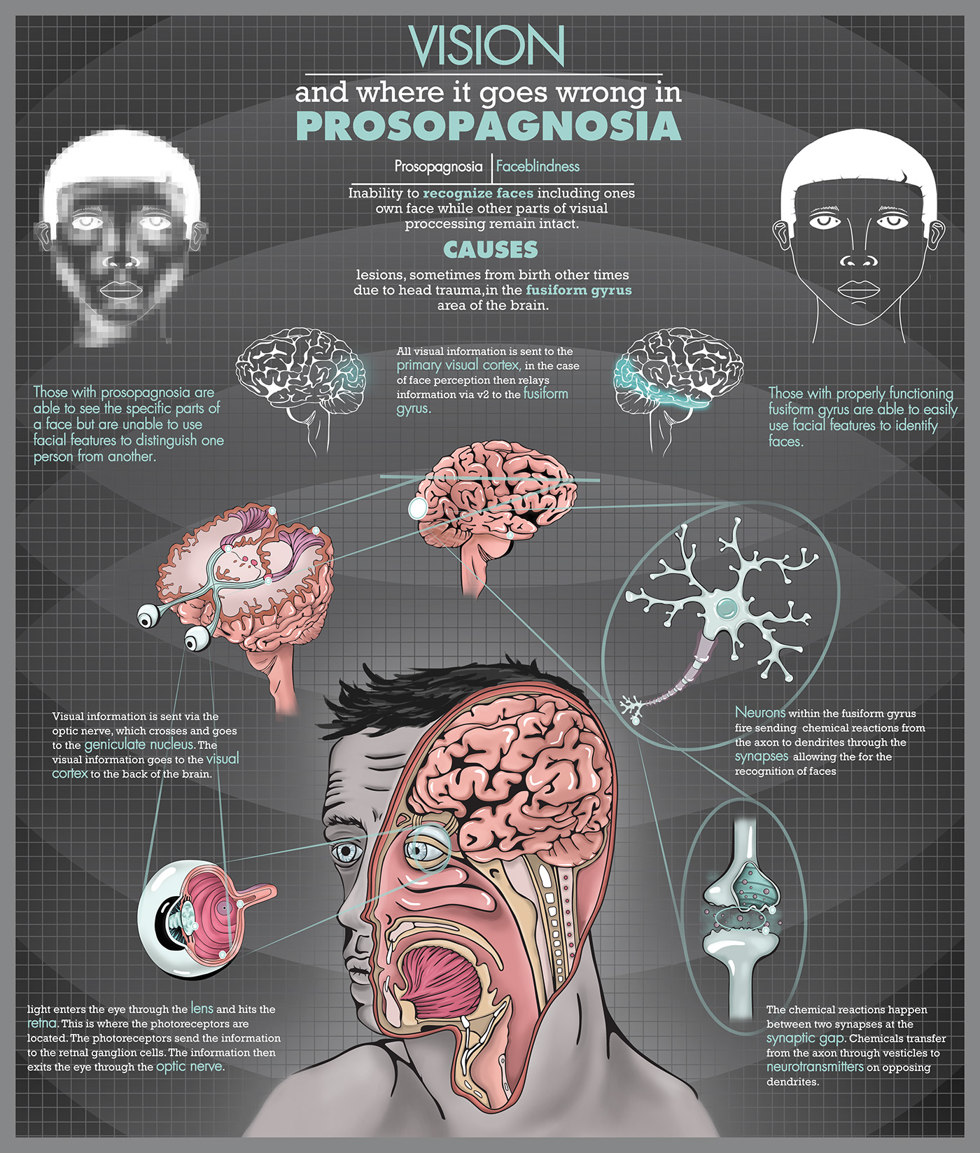 case study of prosopagnosia