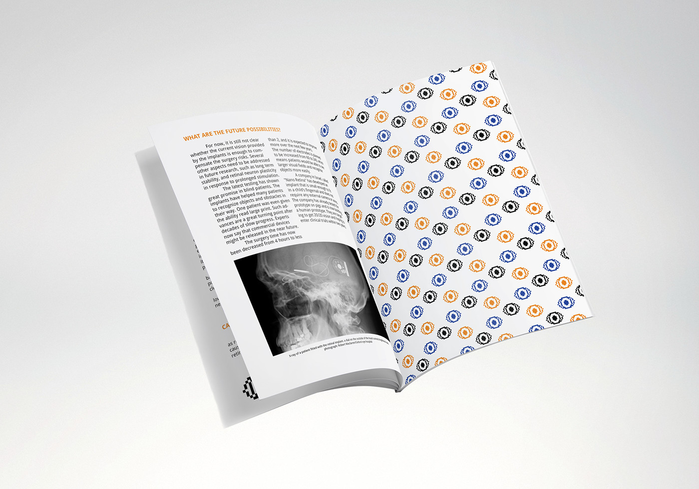 retinal implants implant infographics brochure Braille sight