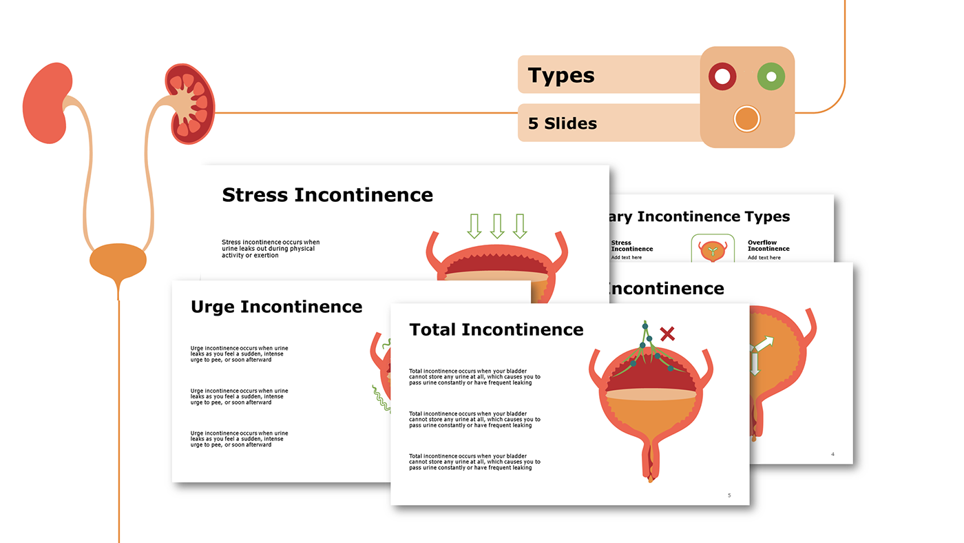 urinary incontinence types