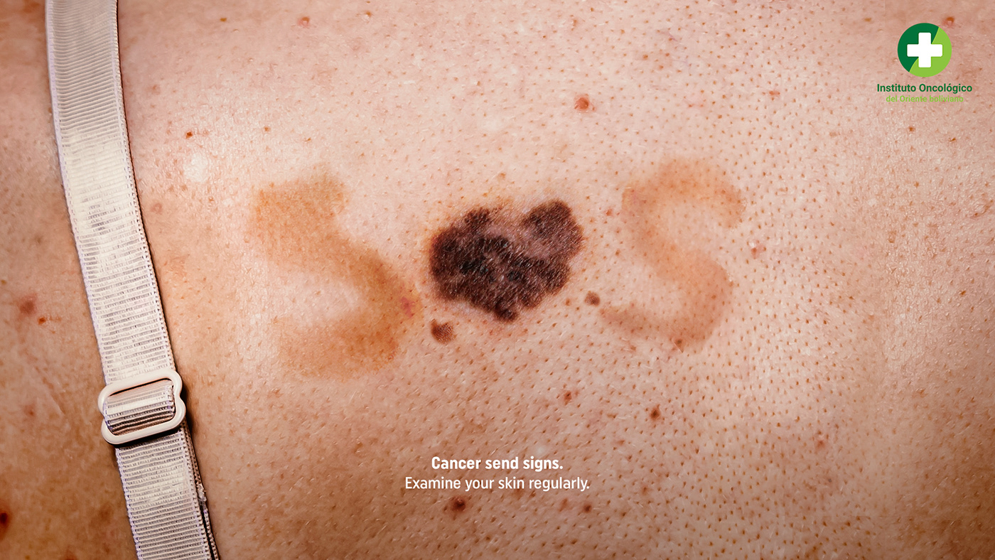 cancer cancer awareness cancer campaign Advertising  ads cancer de piel skin cancer skin cancer awareness Melanoma Health