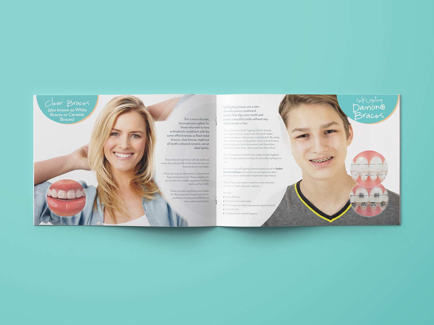 dentist orthodontics brochure Landscape braces retainers children teens