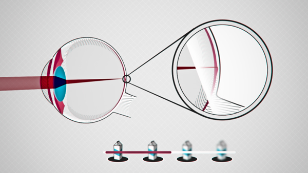 after effects infographics 2D 3D Cell eye type