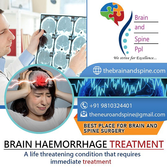 brain hemorrhage Subarachnoid hemorrhage