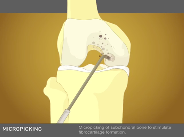 Website osteochondral defects doctor site