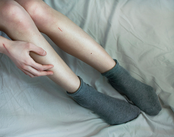 self portrait Fragile skin legs arms body girl sorrow pain hands pale blue cold