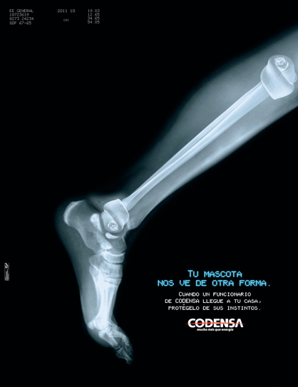bone Radiografia leg radiography