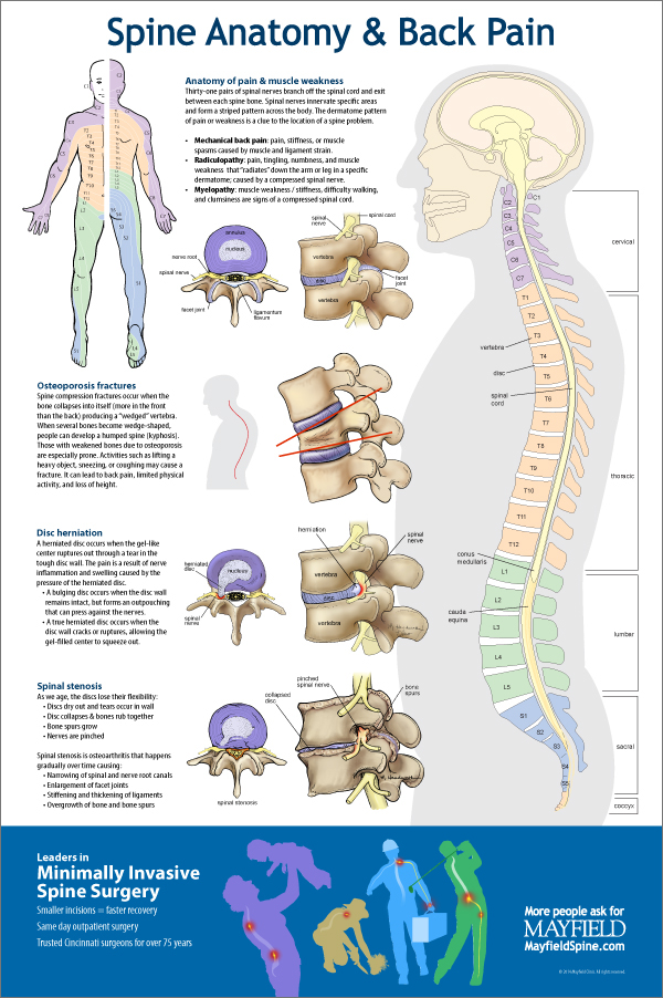 spine anatomy osteoporosis herniated stenosis body pain