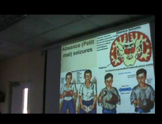 Sanjoy Sanyal SEIZURES epilepsy Neuroscience lectures MUA Professor Neuroscience petit mal