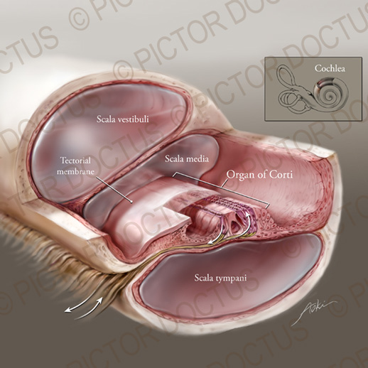 medical illustrator  medical  graphics Illustrator  Illustration  anatomical  anatomy  surgical  surgery  Biomedical  biological  scientific science  animation images  patient education