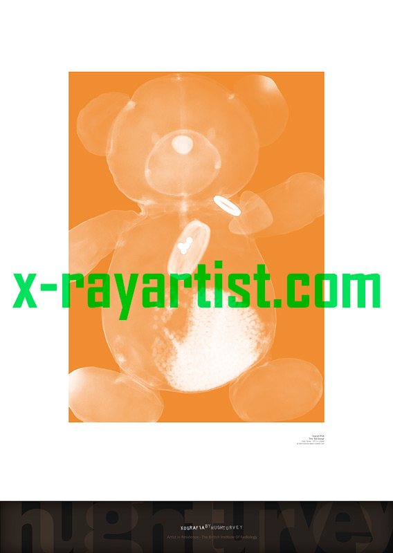 x-ray  xray rayos radiograph