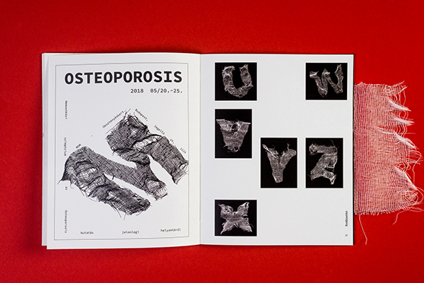 Osteoporosis Images | Photos, videos, logos, illustrations and branding on  Behance