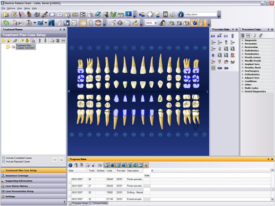 Dentrix Tooth Chart