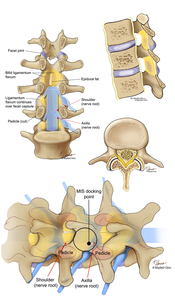 spine anatomy Neurosurgery surgery medical