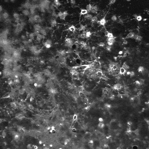 neuron synapse neural brain 3dmodel medicine science organic biology anatomy