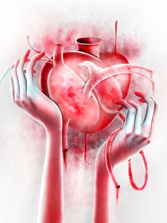 infarto corazon heart ilustración corazon heart attack Ilustración Colombia ilustración cali infarct infarct illustration experimental heart william ibanez