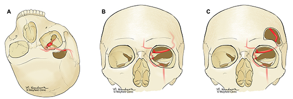 anatomy medical illustration artery larynx skull
