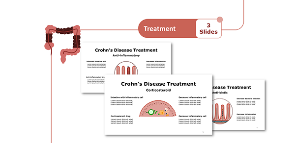 Crohn’s Disease PowerPoint Presentation Template