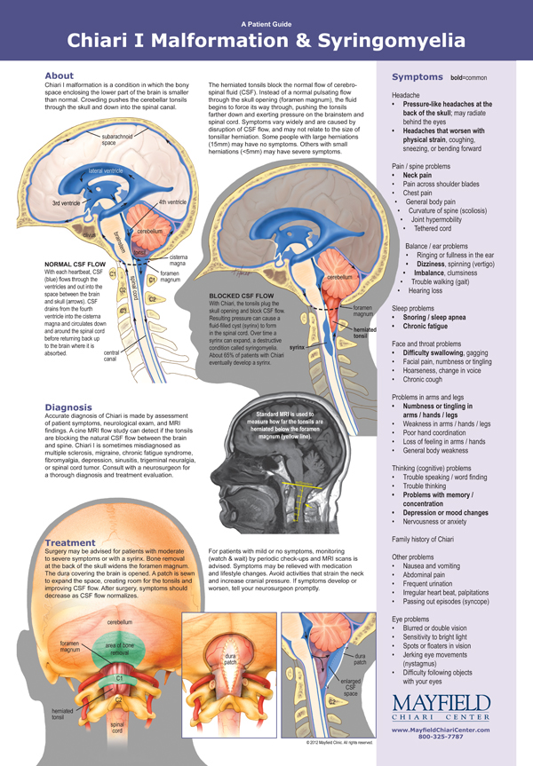 Chiari spine cerebellum anatomy