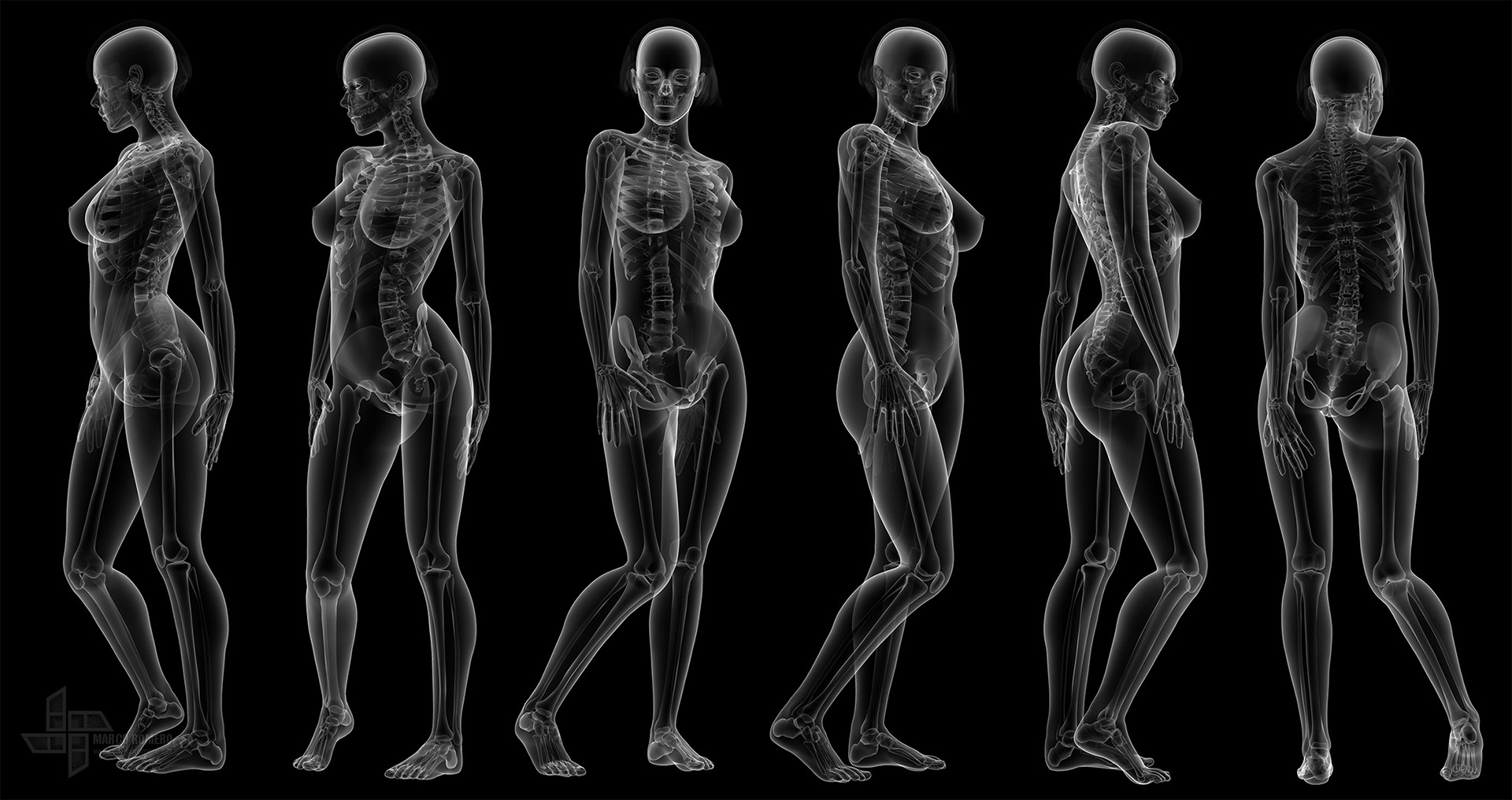 Рентген тела женщины