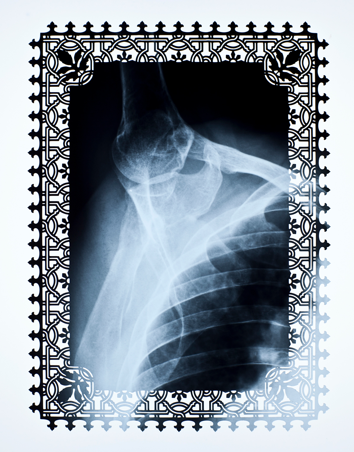 x-rays skeleton lace doilies decoration medical anatomy Lasercut cut