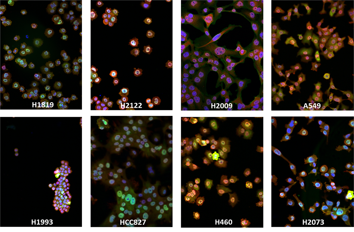 cancer chaos Entropy energy immunotherapy wabi-sabi