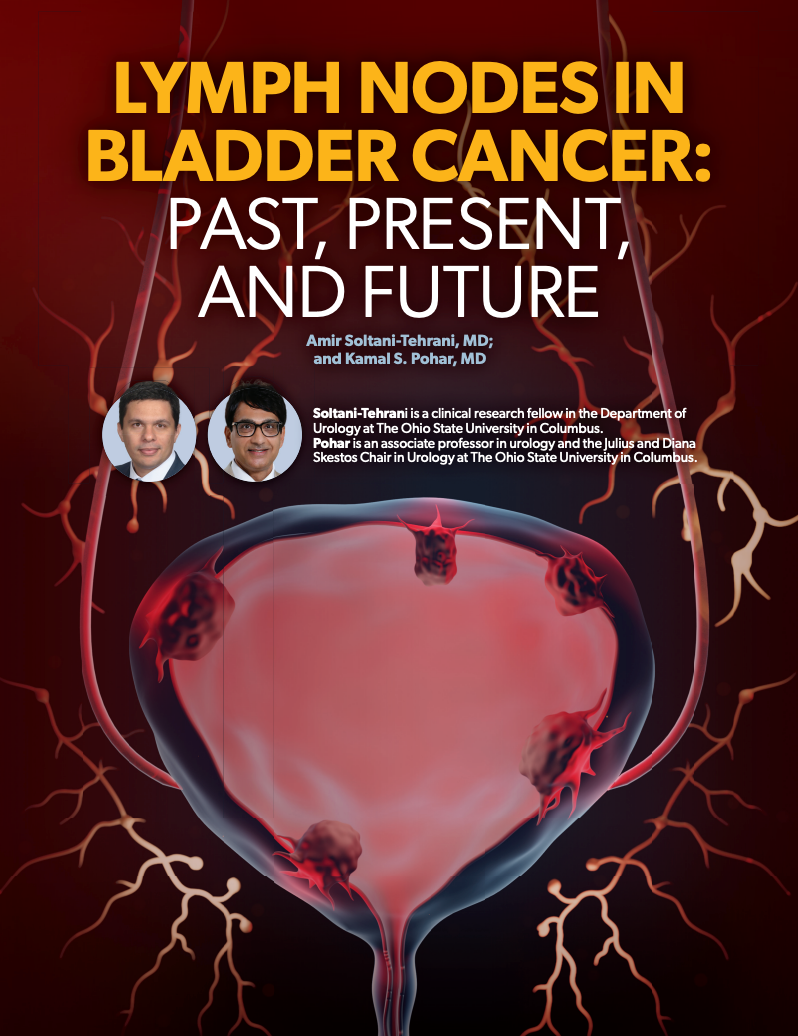 medical medical illustration scientific editorial cancer SciArt scientific illustration blender3d bladder cancer lymph nodes